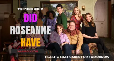 Roseanne's Transformation: Unveiling Her Plastic Surgery Journey and Choices