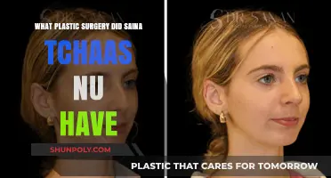 Saina Tchaas Nu's Plastic Surgery: Unveiling Her Transformation Journey