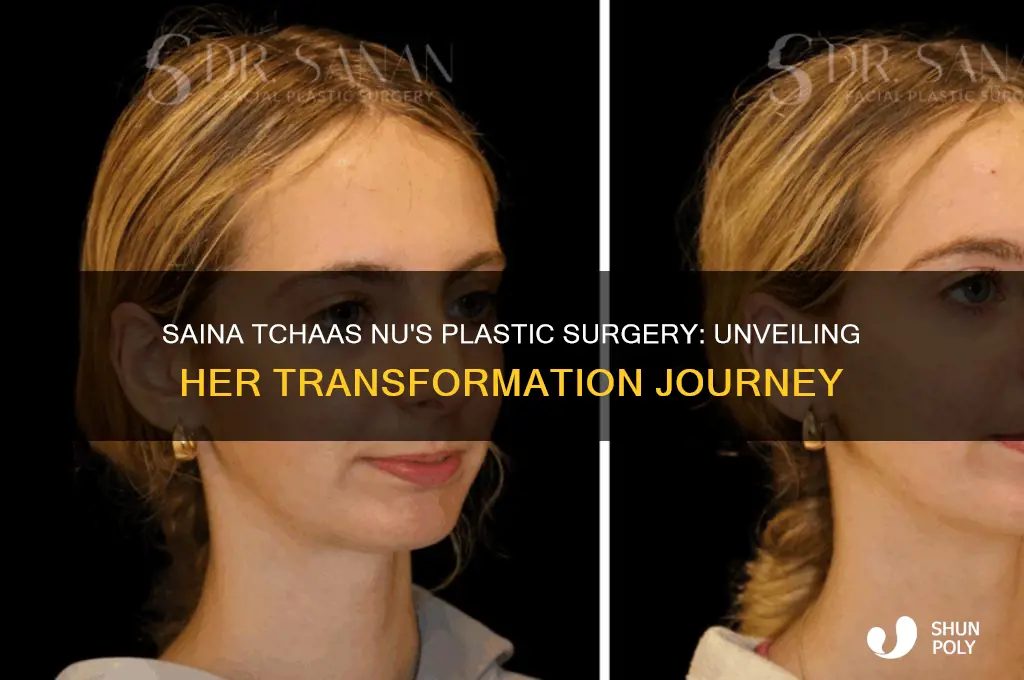 what plastic surgery did saina tchaas nu have
