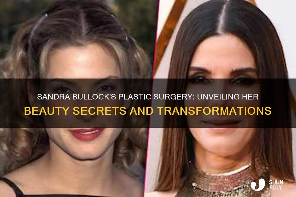 what plastic surgery did sandra bullock have