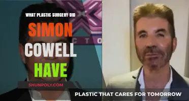 Simon Cowell's Plastic Surgery: Unveiling His Transformative Procedures and Results