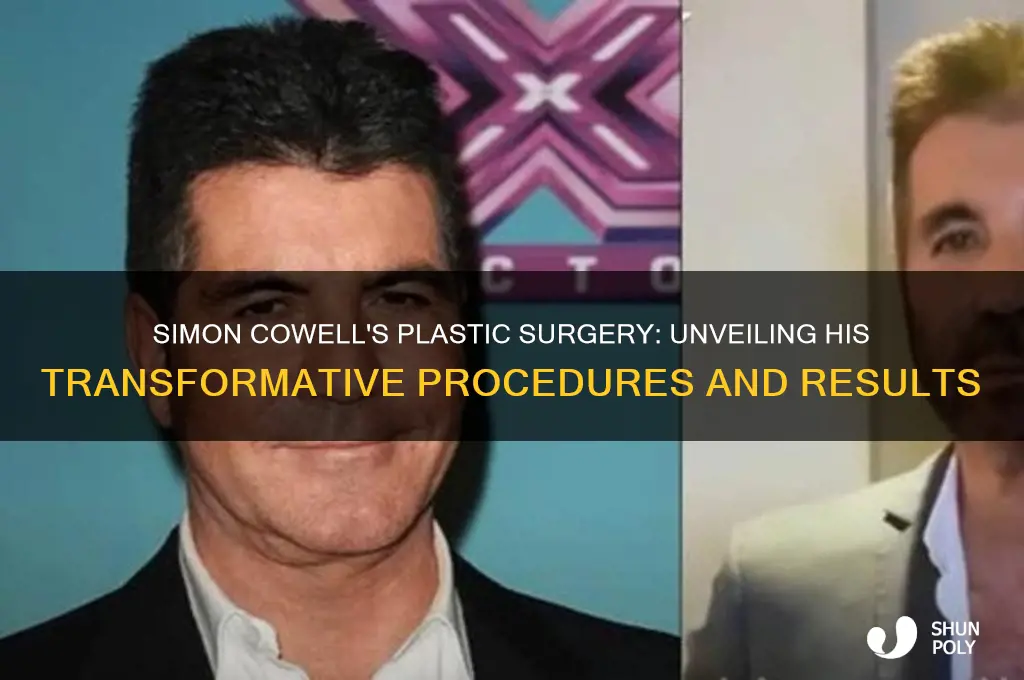 what plastic surgery did simon cowell have