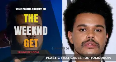 The Weeknd's Transformation: Unveiling His Plastic Surgery Journey