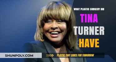 Tina Turner's Plastic Surgery Journey: What Procedures Did She Undergo?