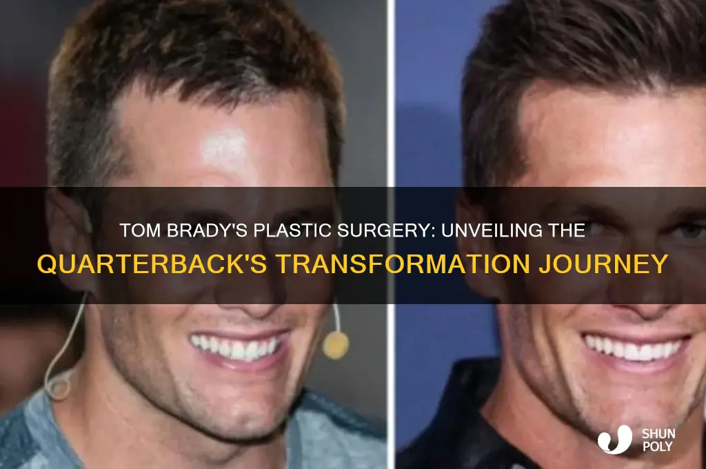 what plastic surgery did tom brady get