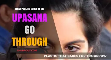 Upasana's Plastic Surgery Journey: Procedures and Transformations Revealed