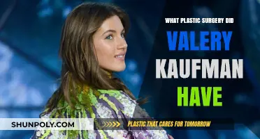Valery Kaufman's Plastic Surgery: Unveiling Her Transformation Journey