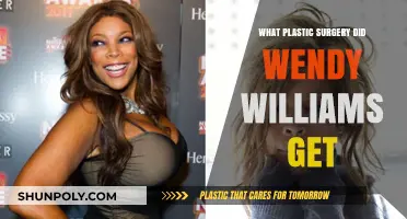 Wendy Williams' Plastic Surgery Journey: Procedures and Transformations Revealed
