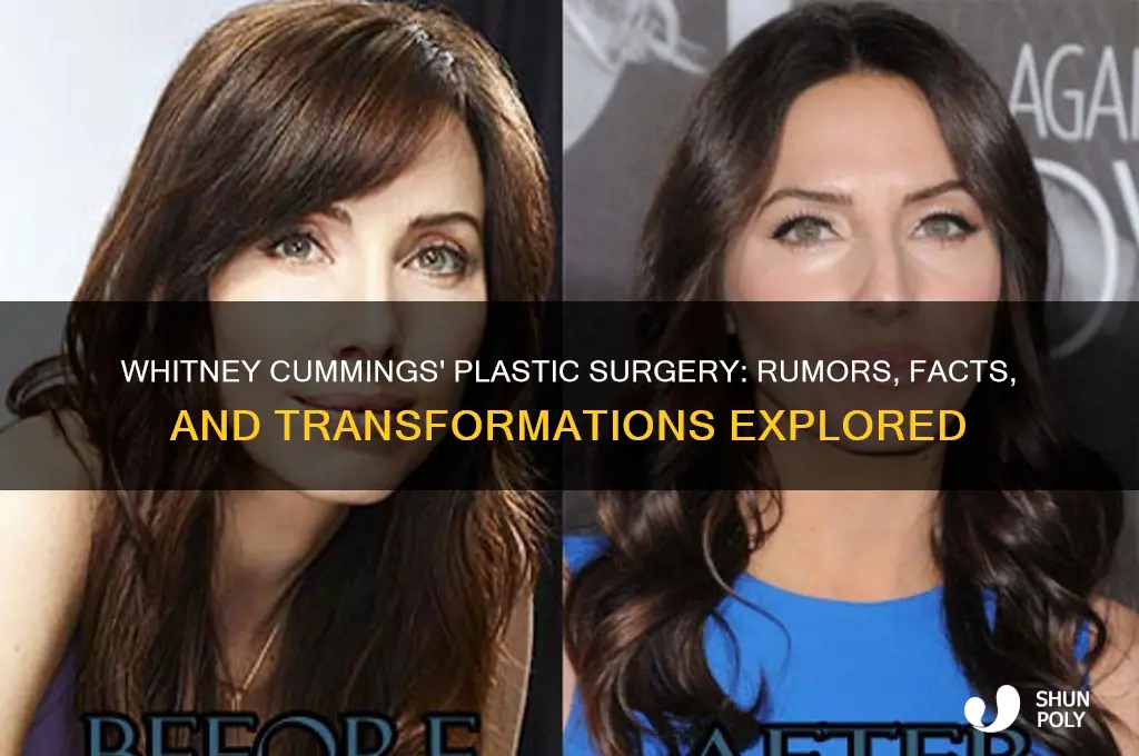 what plastic surgery did whitney cummings have