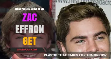 Zac Efron's Plastic Surgery: Unveiling the Truth Behind His Transformation