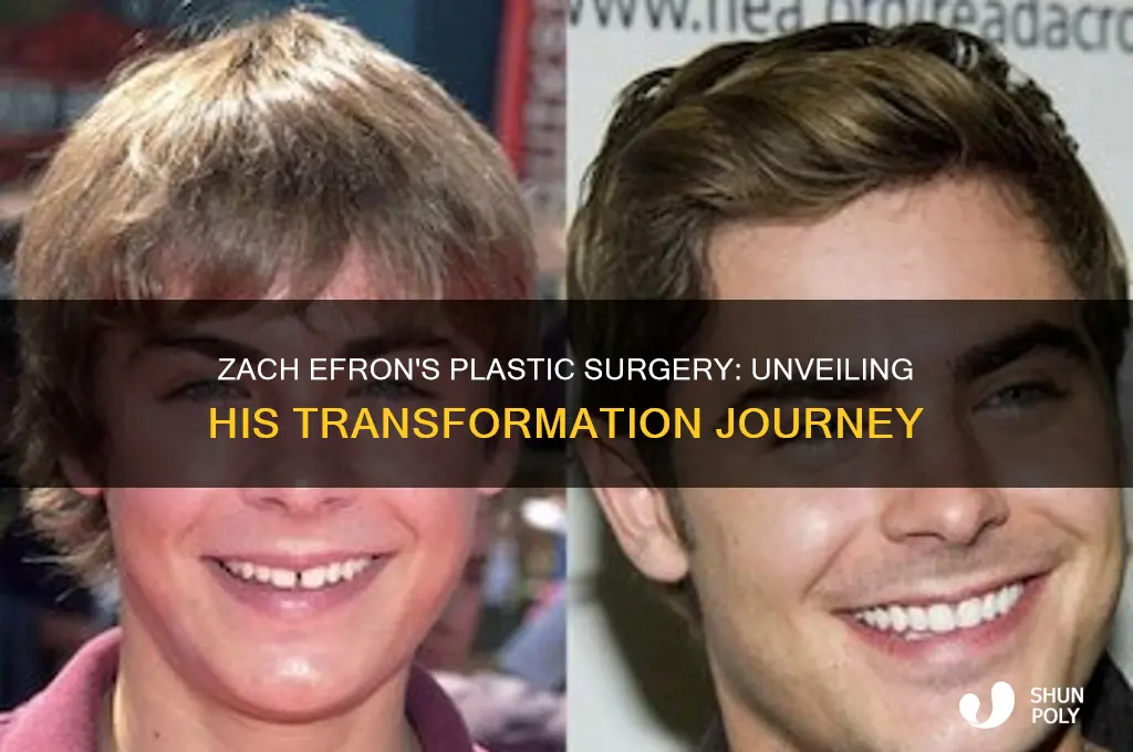 what plastic surgery did zach efron get