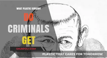 Criminal Makeovers: Unveiling Plastic Surgeries Used to Evade Justice