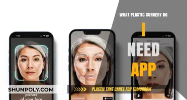 Discover Your Ideal Plastic Surgery with This Innovative App