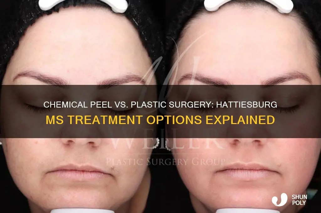 what plastic surgery does chemcial peel in hattiesburg ms