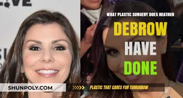 Heather Dubrow's Plastic Surgery: Procedures and Transformations Revealed