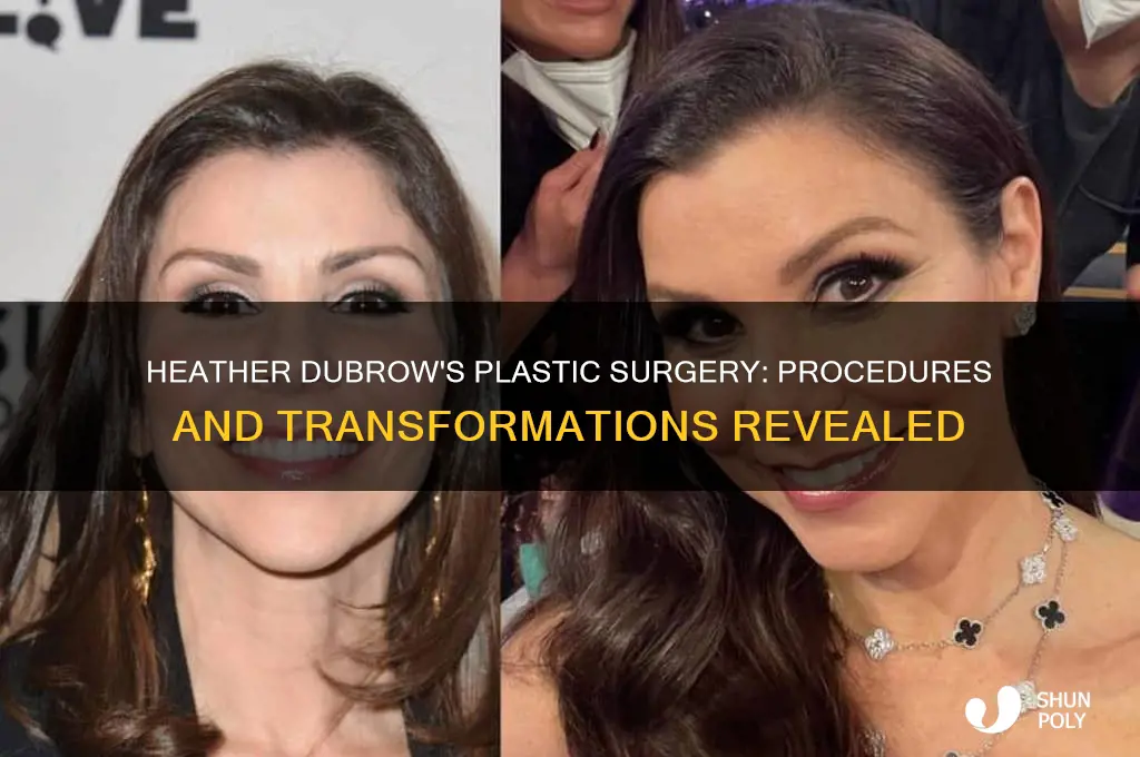 what plastic surgery does heather debrow have done