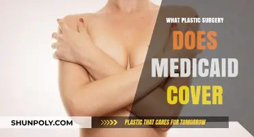 Medicaid Coverage for Plastic Surgery: What Procedures Are Included?
