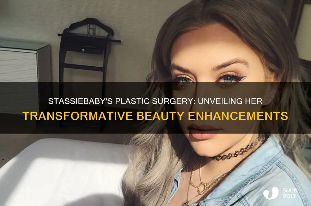 what plastic surgery does stassiebaby have