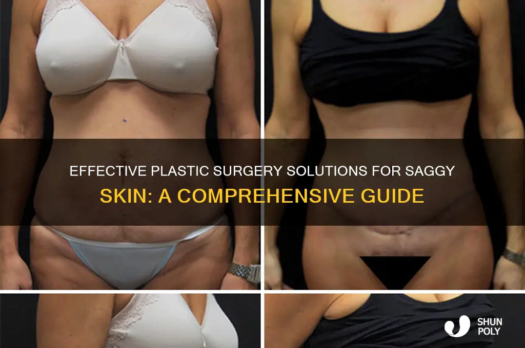 what plastic surgery for saggy skin