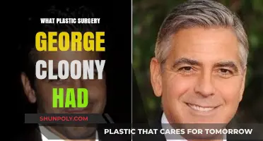 George Clooney's Plastic Surgery: Unveiling His Transformation Journey