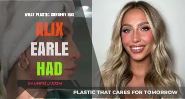 Alix Earle's Plastic Surgery: Rumors, Facts, and Transformations Revealed