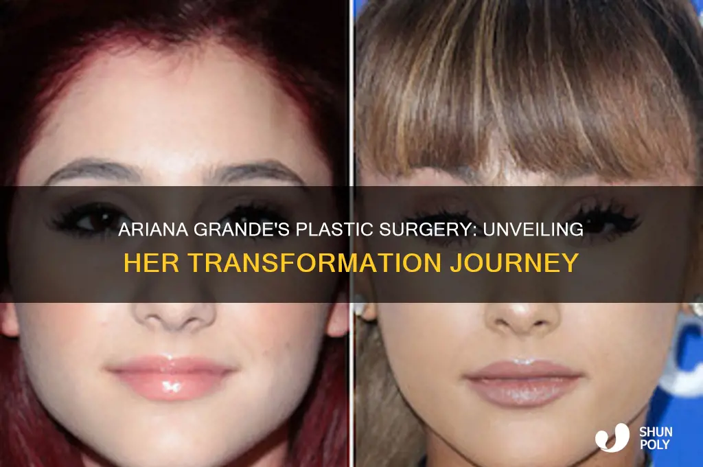what plastic surgery has ariana had