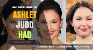 Ashley Judd's Plastic Surgery: Rumors, Facts, and Transformation Speculations