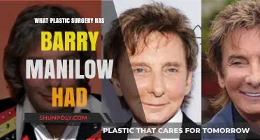 Barry Manilow's Plastic Surgery: Rumors, Facts, and Transformations Revealed