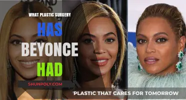 Unveiling Beyoncé's Beauty Secrets: Plastic Surgery Speculations and Facts