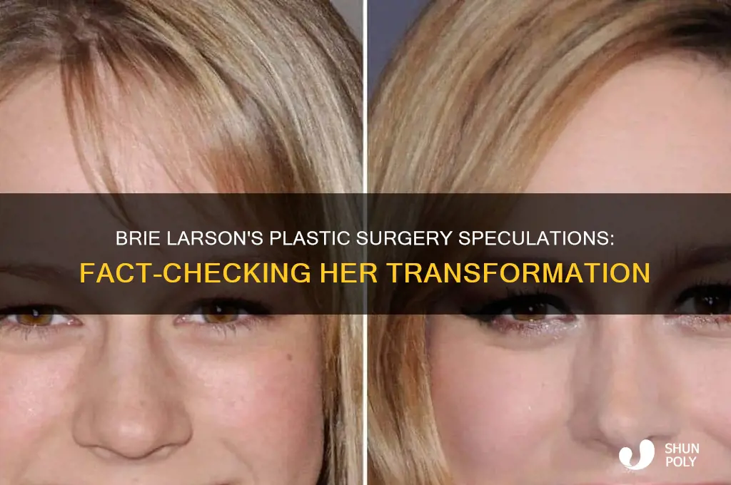 what plastic surgery has brie larson gotten