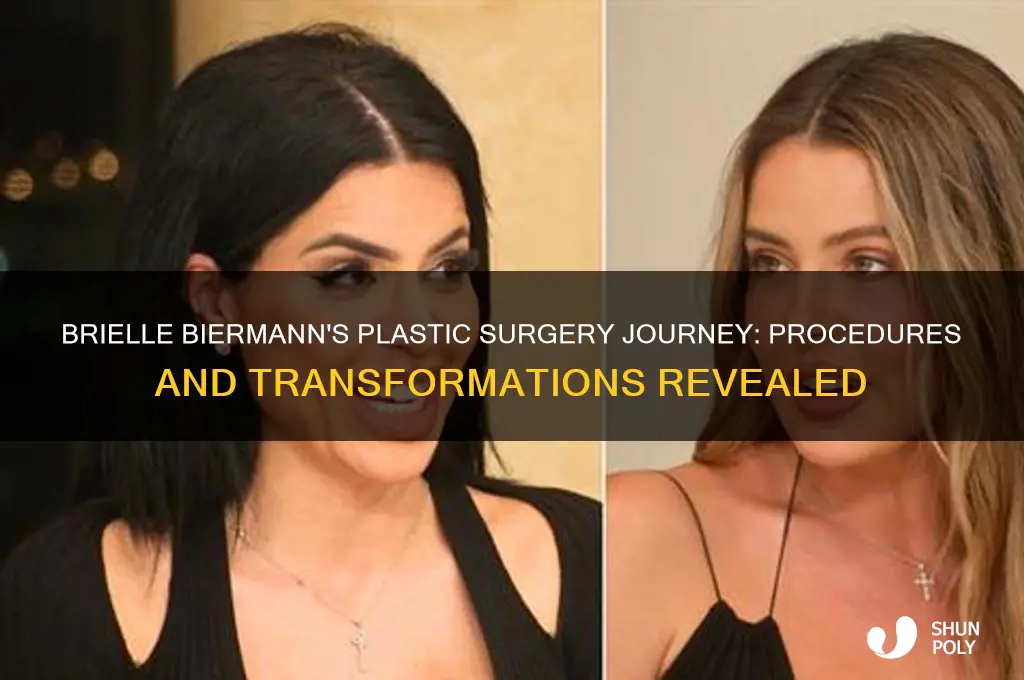 what plastic surgery has brielle biermann had