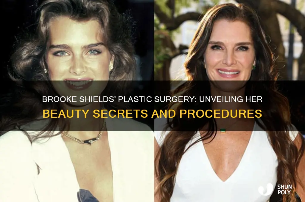 what plastic surgery has brooke shields had
