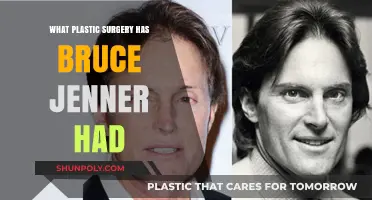Bruce Jenner's Transformation: Unveiling the Plastic Surgery Journey