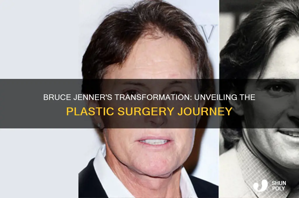 what plastic surgery has bruce jenner had