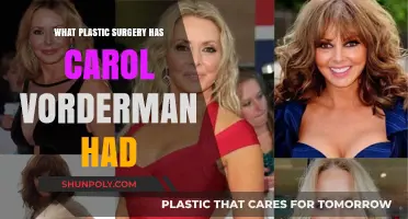 Carol Vorderman's Plastic Surgery: Rumors, Facts, and Transformations Revealed