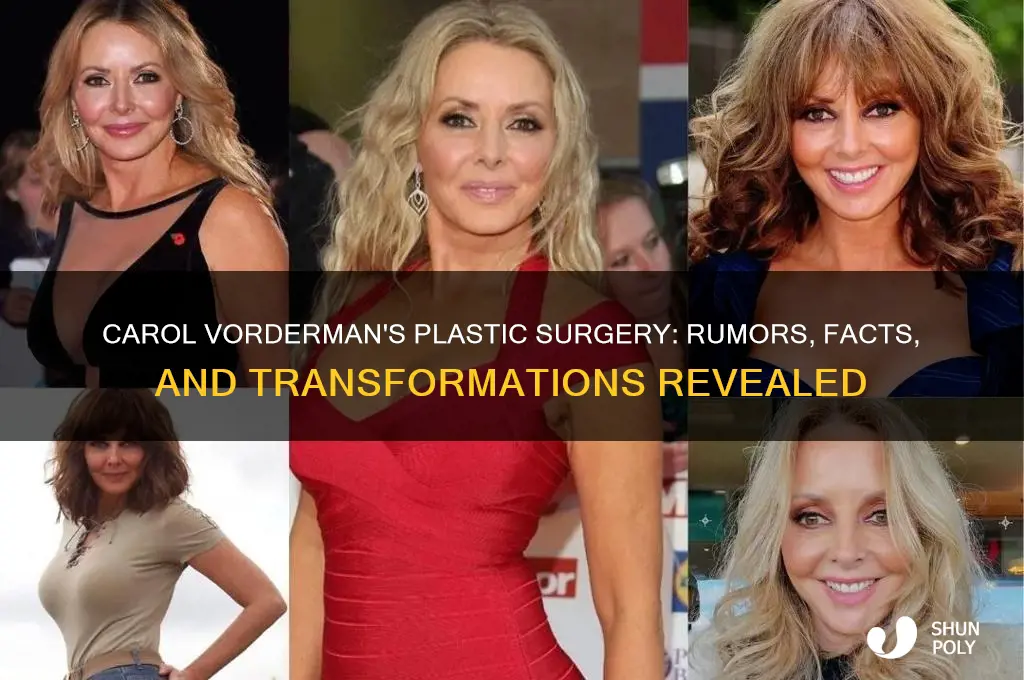 what plastic surgery has carol vorderman had