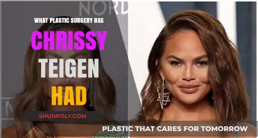 Chrissy Teigen's Plastic Surgery Journey: What Procedures Has She Had?