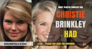 Christie Brinkley's Plastic Surgery Journey: Procedures and Results Revealed