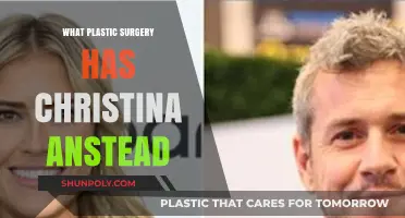 Christina Anstead's Plastic Surgery: Rumors, Facts, and Transformations Revealed