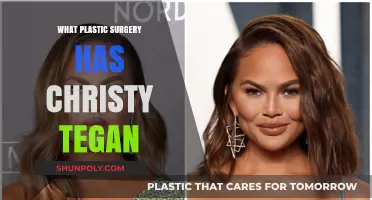 Christy Teigen's Plastic Surgery Journey: Procedures and Transformations Revealed