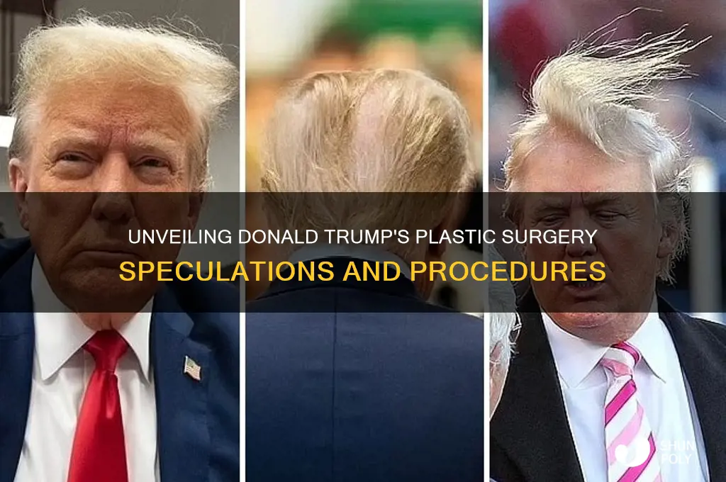 what plastic surgery has donald trump had