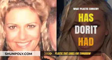 Dorit's Plastic Surgery Journey: Rumors, Procedures, and Transformation Revealed
