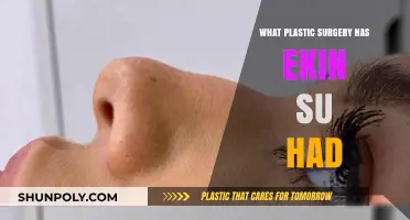 Ekin-Su's Transformation: Unveiling Her Plastic Surgery Journey and Procedures