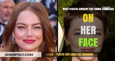 Emma Stone's Facial Plastic Surgery: Rumors, Facts, and Transformations