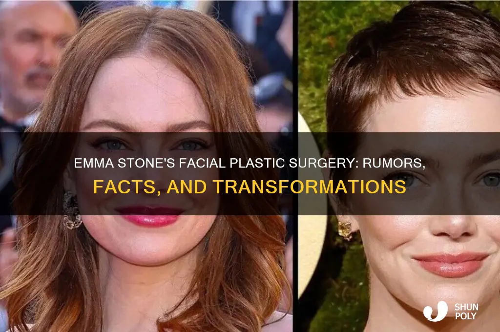 what plastic surgery has emma stone had on her face