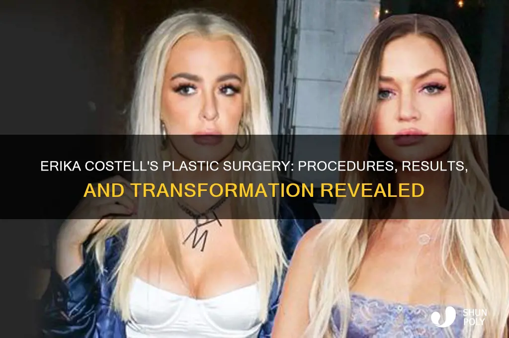 what plastic surgery has erika costell had