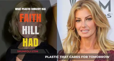 Faith Hill's Plastic Surgery: Rumors, Facts, and Transformation Journey