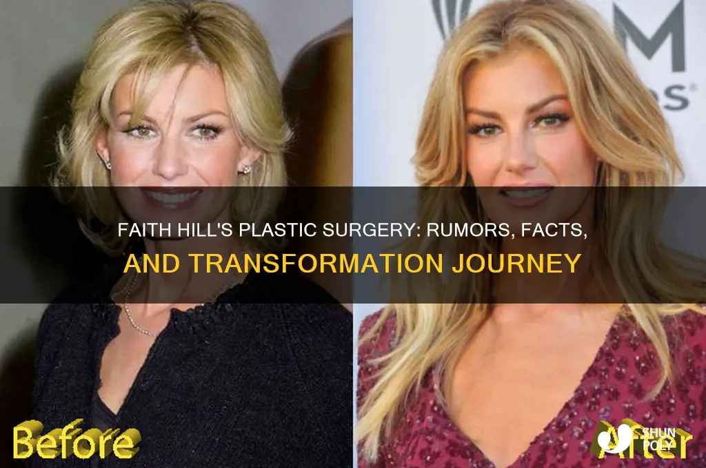 what plastic surgery has faith hill had