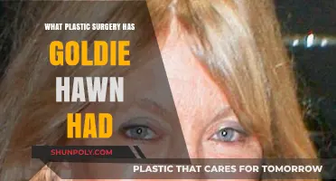 Goldie Hawn's Plastic Surgery: Unveiling Her Transformative Beauty Secrets