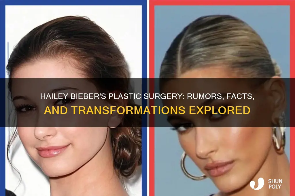 what plastic surgery has hailey bieber had
